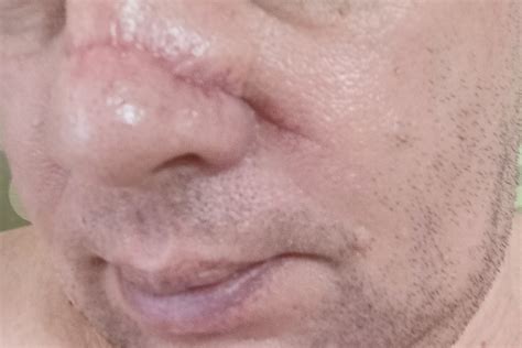 У вас есть шрамы? Расскажите, как вы их получили и как к ним относитесь