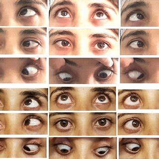 measurement   gaze deviation   degree  hand held