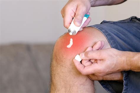 Gentamicina crema: a cosa serve e altre domande frequenti