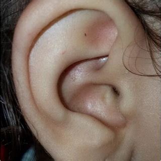 auricular template   parts copied  plain  ray papers