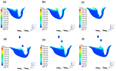Numerical Simulation of Molten Pool Dynamics in Laser Deep Penetration
