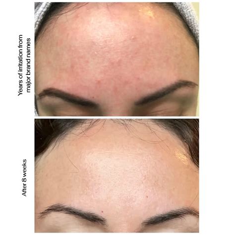 Transform Your Skin with Best Products : Finally All Natural