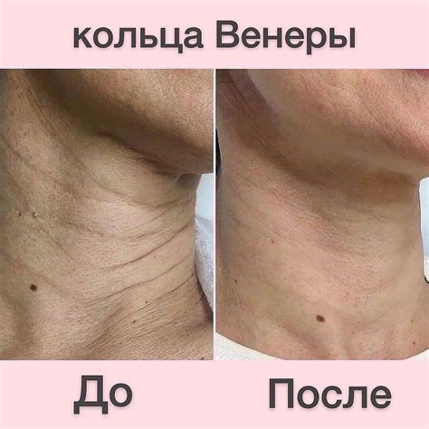 Онлайн-курс ️ TOP FACE on Instagram: “Кольца Венеры – это поперечные ...