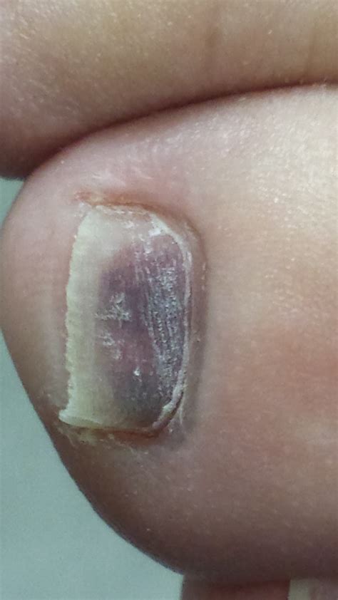 20140610_120506(1) | Foot Care Specialist - Doctor Anthony Chionis