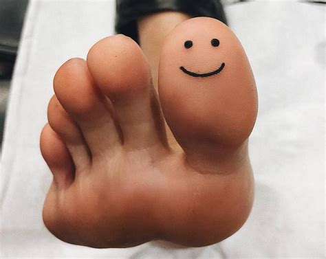 how long does a bruised toenail take to heal