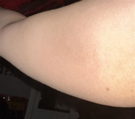 I’m unsure on what this is it’s been very itchy can anyone help me
