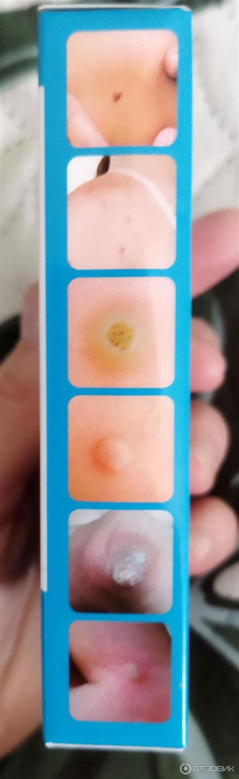Отзыв о Пластырь от сухих мозолей South Moon "Corn Removal Plaster ...