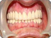 ultra dental hospital