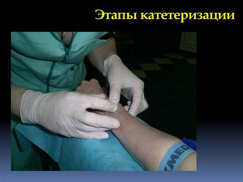 Катетеризация вен - презентация онлайн