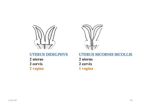Hysterosalpingography | PPTX