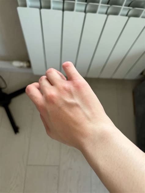 #veins #hand #hands #вены #руки #finger #сосуды #vessels | Руки