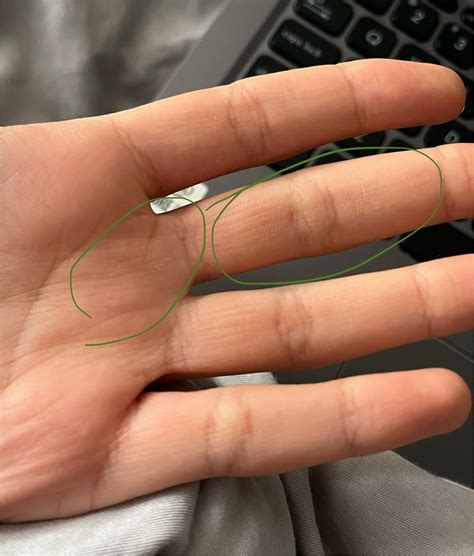 Is this just dry skin or some sort of fungal infection? : r/SkincareAddicts