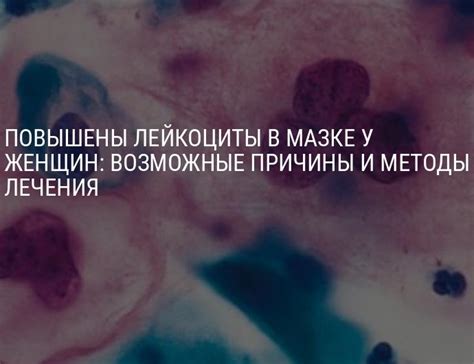 Повышены лейкоциты в мазке у женщин в мазке по гинекологии: от чего и ...
