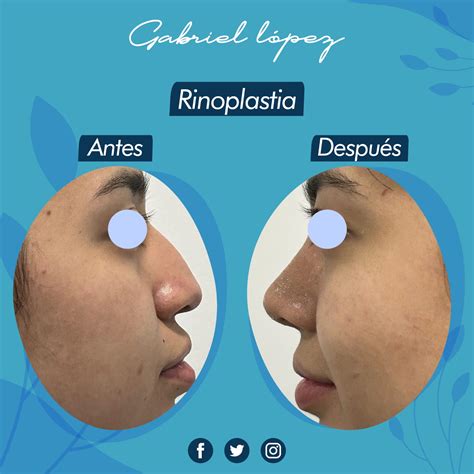 Les mostramos el resultado... - Dr. Gabriel Lopez Caballero