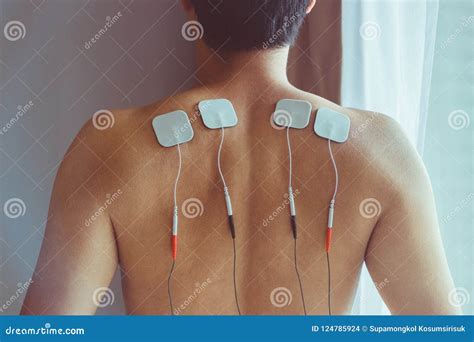 TENS Treatment In Physical Therapy. Young Man With TENS On His B ...