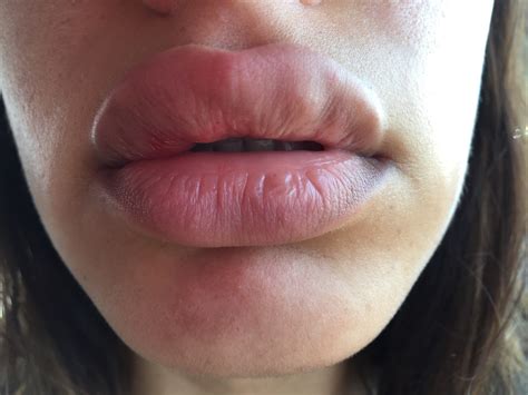 Medical experts finally describe what lips are quivering really signifies 17