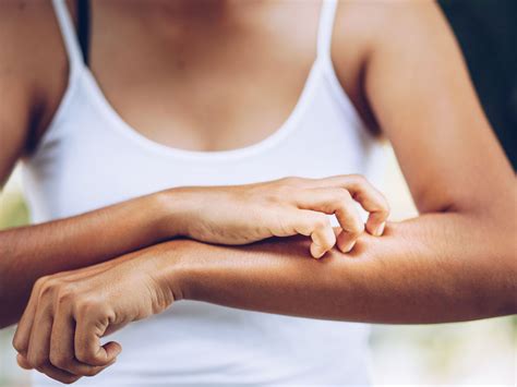 The Search for What Causes Chronic Itching