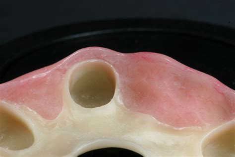 Biodentaplast - Zahntechnische Meisterwerkstatt Kipping & Zeitler