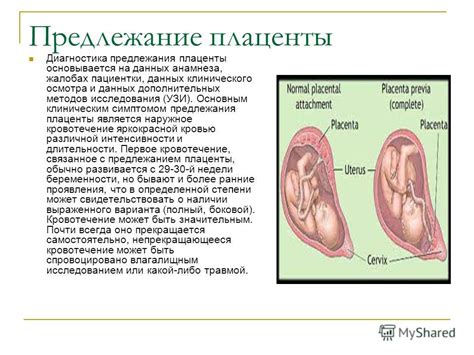 Презентация на тему: "Патологическое течение беременности, родов ...
