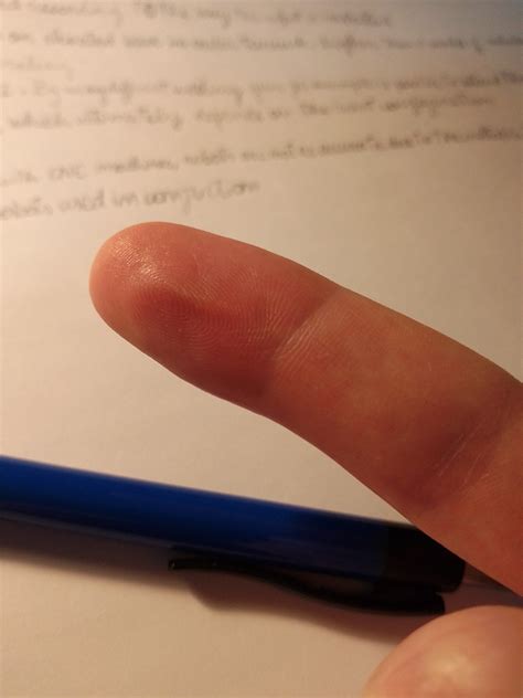Developed a pinch callus, had to improvise : r/EngineeringStudents