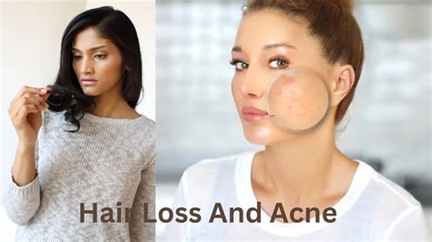 signs  hormonal imbalance  women