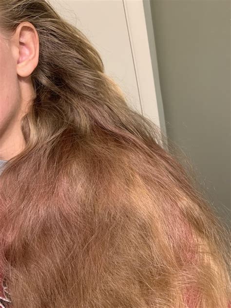 how to get splat hair dye out of hair