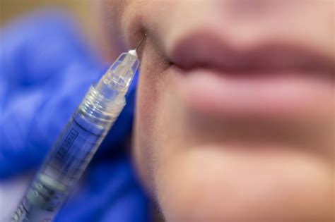 Finding the Premier Botox Injector Near You | Envision Aesthetics