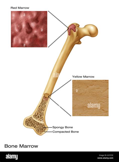 bone marrow jw  elmer pritchard blog