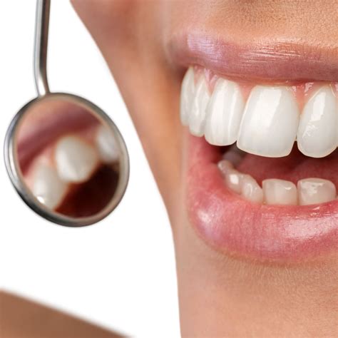 What is the longevity of composite bonding? - Breeze Dental