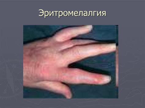 Описание клинического случая - online presentation