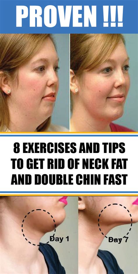 8 Exercises And Tips To Get Rid Of Neck Fat And Double Chin Fast # ...
