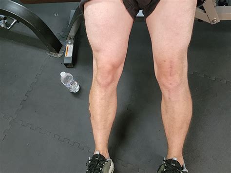 6 weeks post op - am I behind? : r/ACL