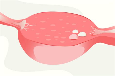 Primary Ovarian Insufficiency: Signs, Causes & Treatment