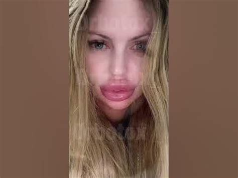 Самые большие губы в мире. - YouTube