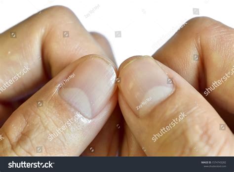 spotted lunula images stock   objects vectors