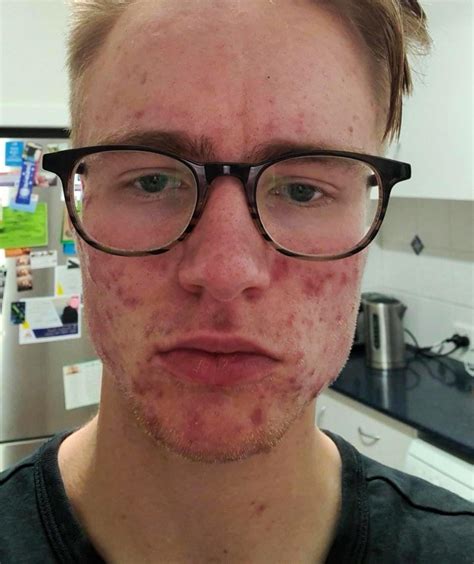pepperoni face