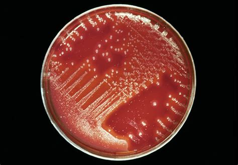 strep  surging   worried  scientists