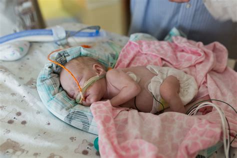 26 Week Fetus Born