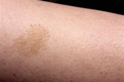 Dear Person Reading This,: Birth Mark