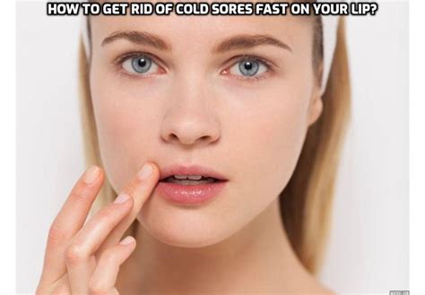 how to get rid of cold sores on lip fast