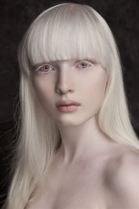 Ethereal portraits highlight the unique beauty of a girl with albinism