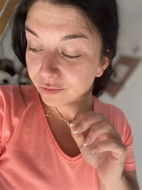 Mum diagnosed with cancer after mistaking mark on her fingernail for a