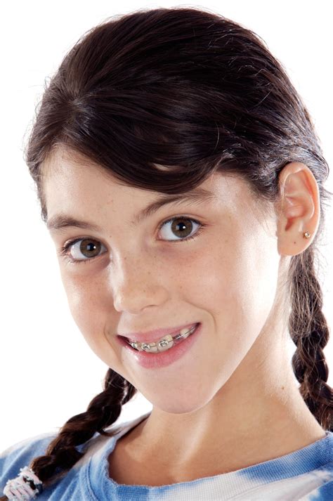 Braces Girl Story at Louise Costa blog