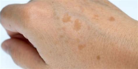 ratakan warna kulit tangan  perlu beli lulur hilang belang