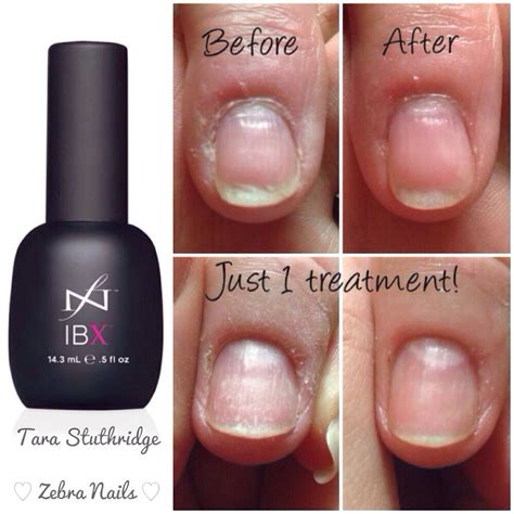 Fact check how does ibx nail strengthening treatment work – Artofit