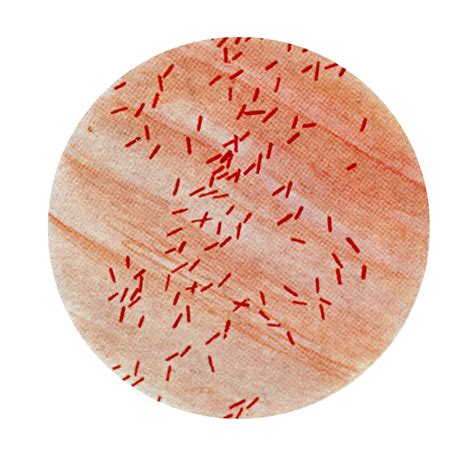 Escherichia Coli Gram Stain Escherichia Coli And Bacillus Sp | My XXX ...