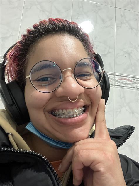 Thicker wires, LET’S GO : r/braces