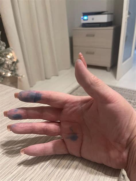 White Stuff Leaking Out Of Shotgun Cartridge