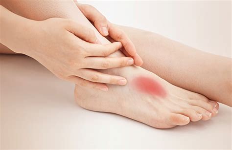 Arthritis Pain Treatment - Mid Ohio Foot & Ankle Specialists