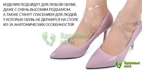 Купить силиконовые прозрачные ремешки для фиксации обуви в интернет ...